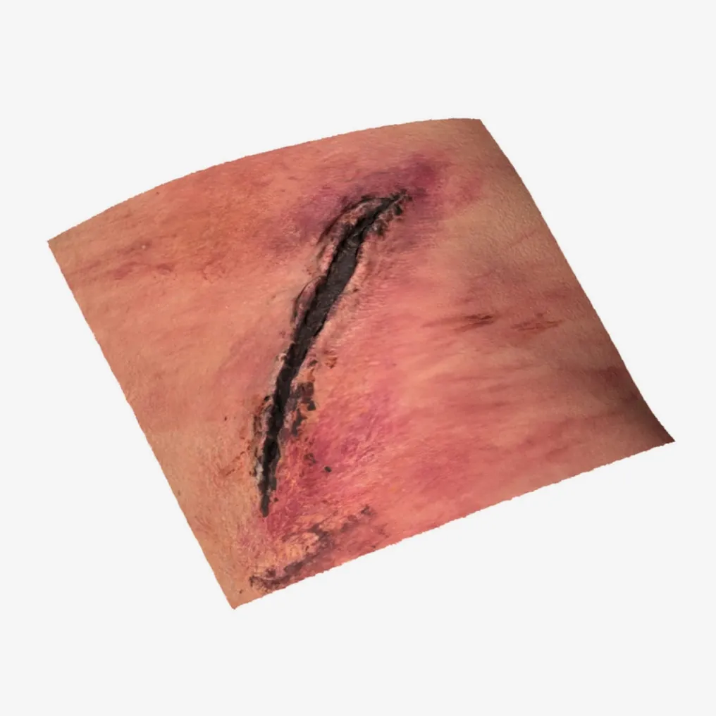 A full-colour 3D scan of a wound on skin
